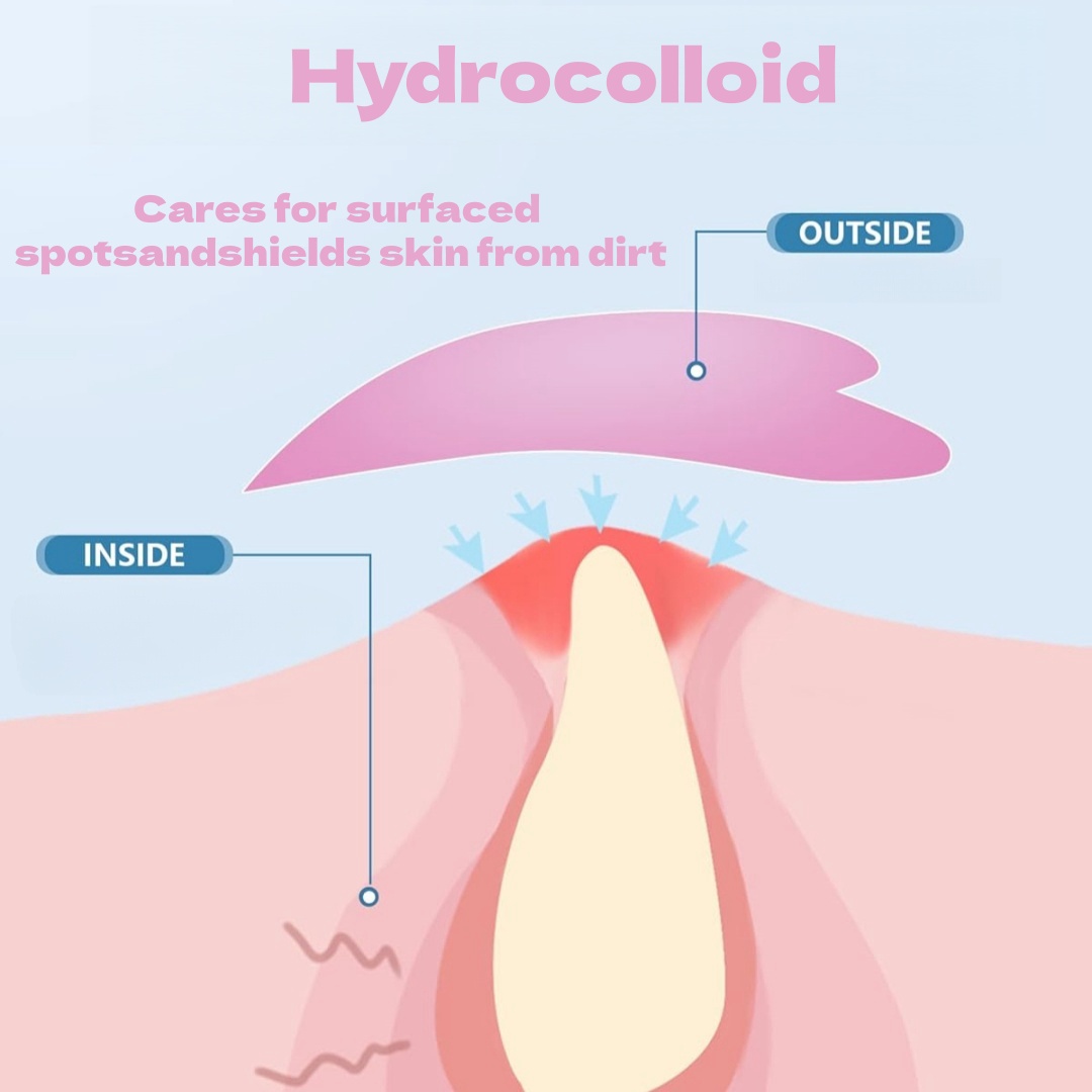 クールな新作ニキビパッチ、ハート型/星型の保湿ニキビパッチ。 - Face Moisturizer のレビューと価格
